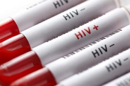 ابتلای ۴۶ هزار نفر به اچ‌آی‌وی در کشور